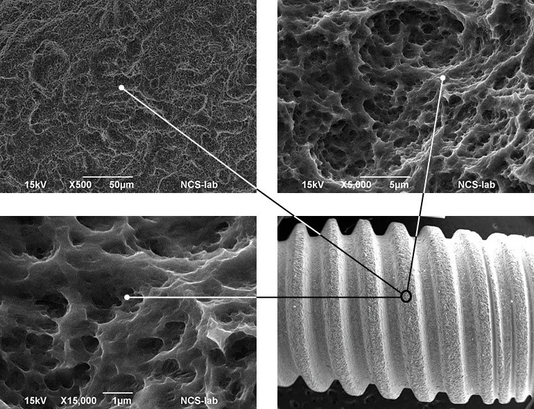 SLActive Surface Treatment SLActive Surface Treatment